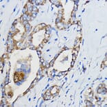 Immunohistochemistry - Anti-CYP51A1/CYP51 Antibody (A92250) - Antibodies.com