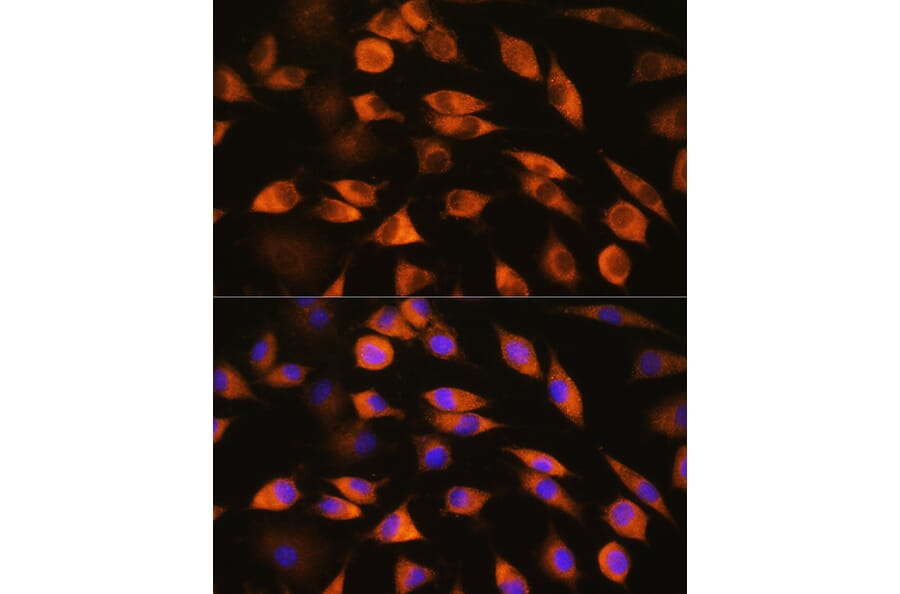Immunofluorescence - Anti-CYP51A1/CYP51 Antibody (A92250) - Antibodies.com