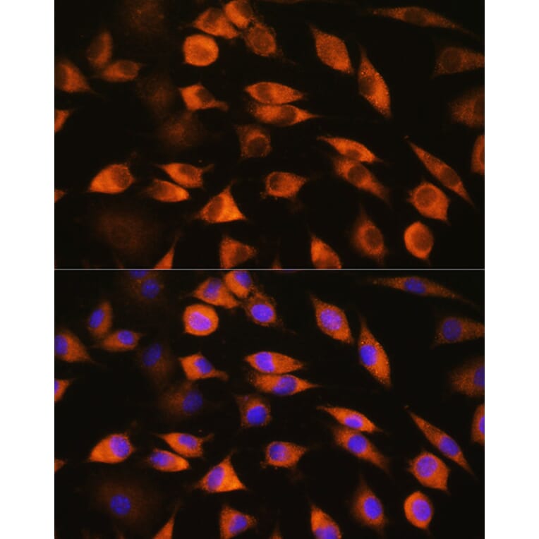 Immunofluorescence - Anti-CYP51A1/CYP51 Antibody (A92250) - Antibodies.com
