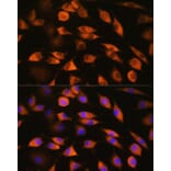 Immunofluorescence - Anti-CYP51A1/CYP51 Antibody (A92250) - Antibodies.com