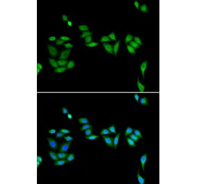 Immunofluorescence - Anti-PHF17 Antibody (A92251) - Antibodies.com