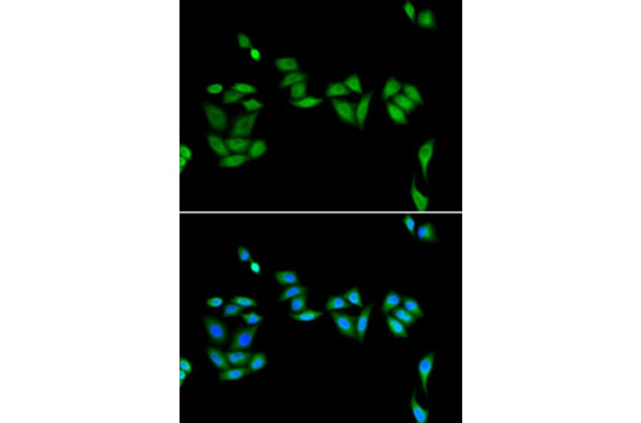Immunofluorescence - Anti-PHF17 Antibody (A92251) - Antibodies.com