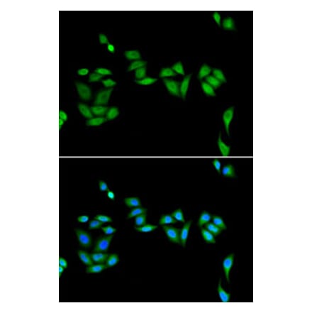 Immunofluorescence - Anti-PHF17 Antibody (A92251) - Antibodies.com