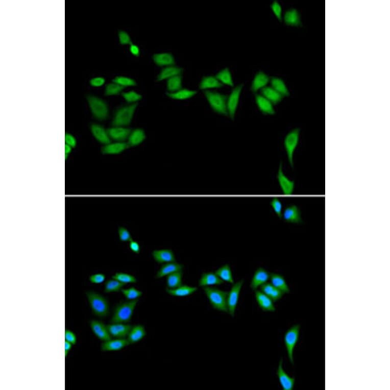 Immunofluorescence - Anti-PHF17 Antibody (A92251) - Antibodies.com