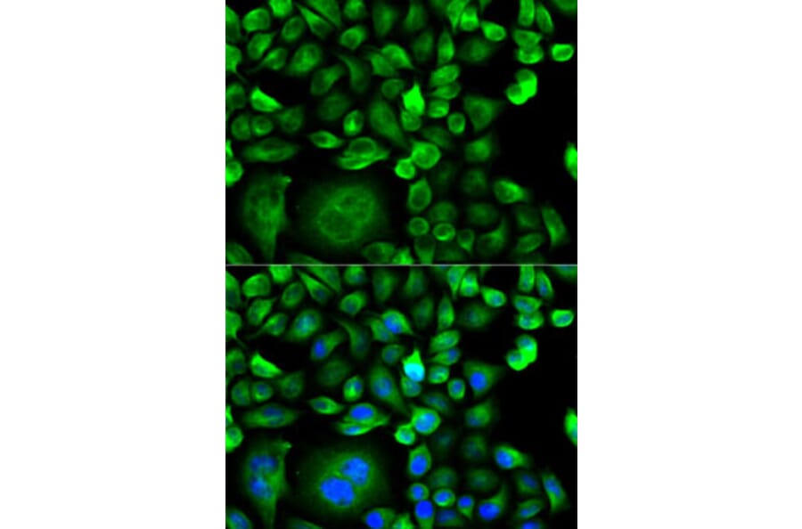 Immunofluorescence - Anti-MSMB Antibody (A13625) - Antibodies.com