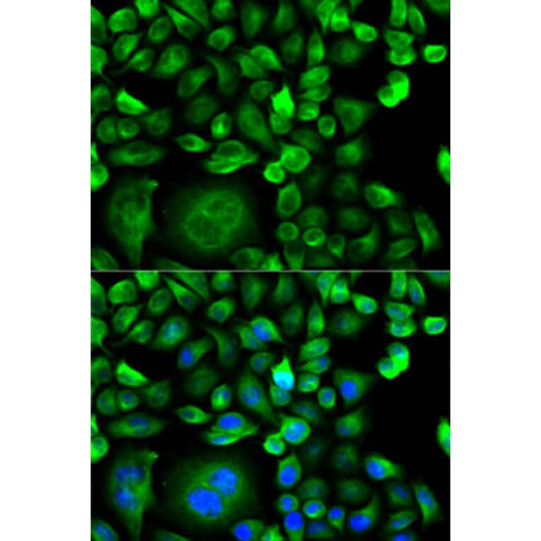 Immunofluorescence - Anti-MSMB Antibody (A13625) - Antibodies.com