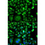 Immunofluorescence - Anti-MSMB Antibody (A13625) - Antibodies.com