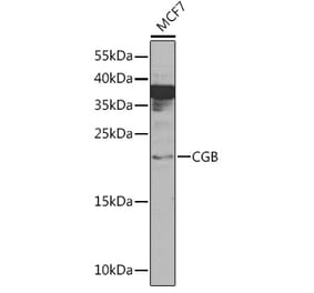 Western Blot - Anti-Choriogonadotropin subunit beta 3 Antibody (A92256) - Antibodies.com