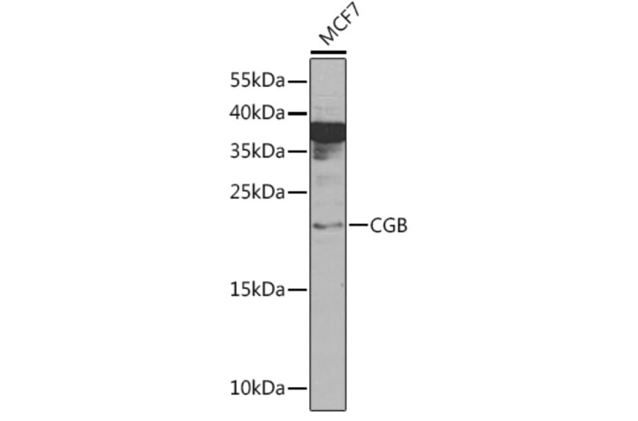Western Blot - Anti-Choriogonadotropin subunit beta 3 Antibody (A92256) - Antibodies.com
