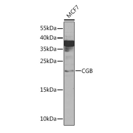 Western Blot - Anti-Choriogonadotropin subunit beta 3 Antibody (A92256) - Antibodies.com