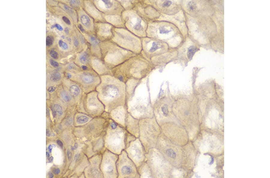 Immunohistochemistry - Anti-IL7R Antibody (A13503) - Antibodies.com