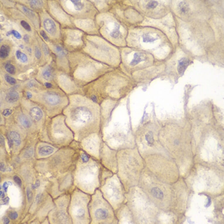 Immunohistochemistry - Anti-IL7R Antibody (A13503) - Antibodies.com