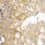 Immunohistochemistry - Anti-IL7R Antibody (A13503) - Antibodies.com