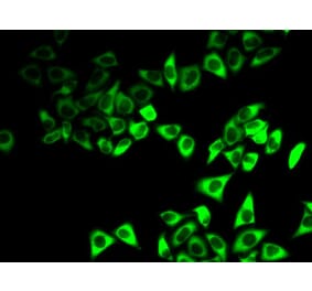 Immunofluorescence - Anti-IGFBP5 Antibody (A92259) - Antibodies.com