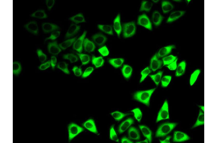 Immunofluorescence - Anti-IGFBP5 Antibody (A92259) - Antibodies.com
