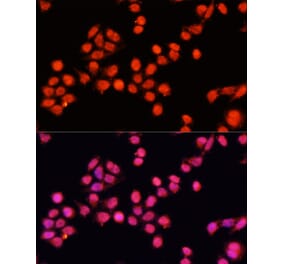 Immunofluorescence - Anti-SLC24A5 Antibody (A92261) - Antibodies.com