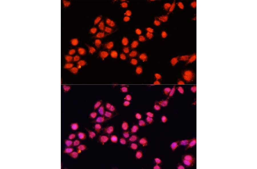 Immunofluorescence - Anti-SLC24A5 Antibody (A92261) - Antibodies.com