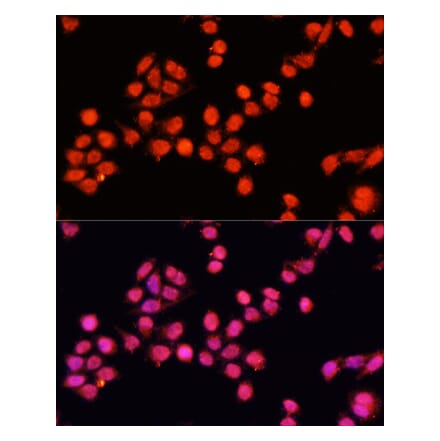 Immunofluorescence - Anti-SLC24A5 Antibody (A92261) - Antibodies.com