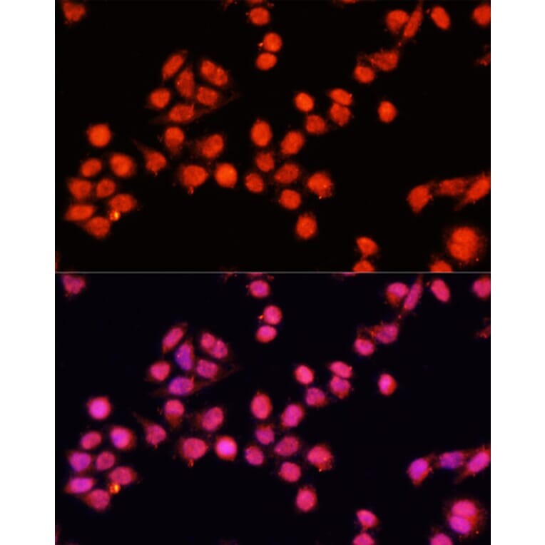 Immunofluorescence - Anti-SLC24A5 Antibody (A92261) - Antibodies.com
