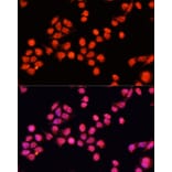 Immunofluorescence - Anti-SLC24A5 Antibody (A92261) - Antibodies.com