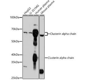 Western Blot - Anti-Clusterin Antibody (A92263) - Antibodies.com