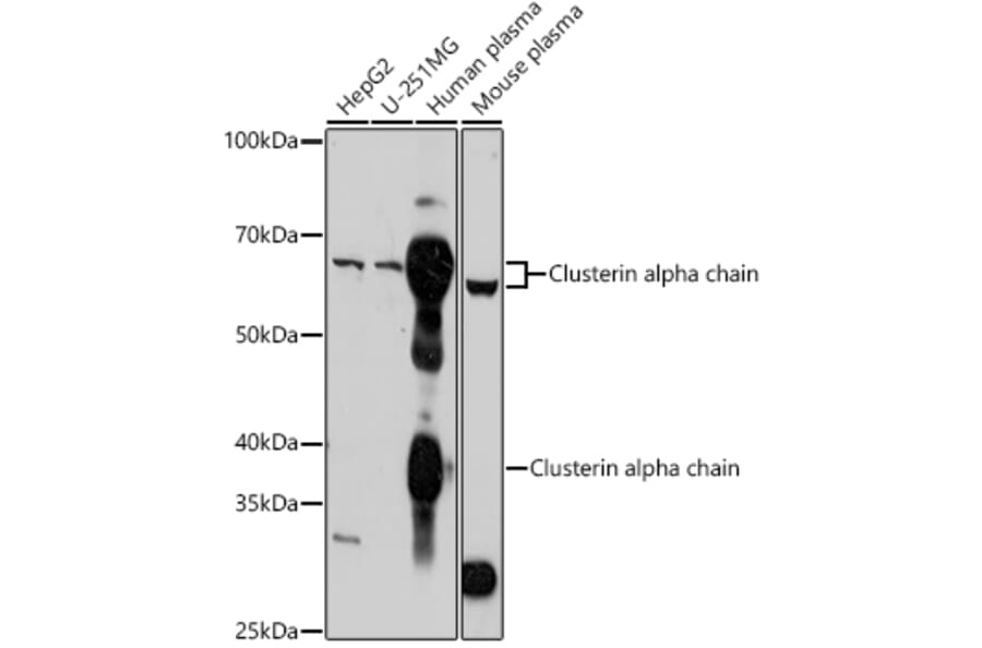 Western Blot - Anti-Clusterin Antibody (A92263) - Antibodies.com
