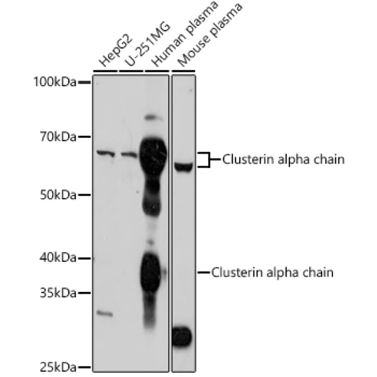 Western Blot - Anti-Clusterin Antibody (A92263) - Antibodies.com