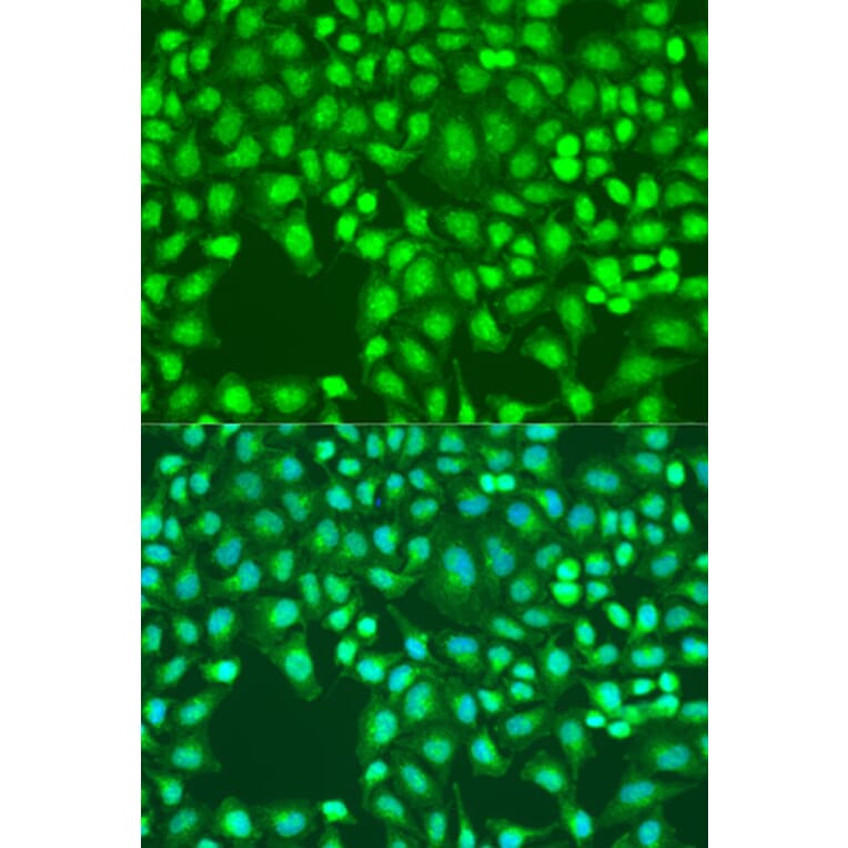 Immunofluorescence - Anti-Defb26 Antibody (A92264) - Antibodies.com