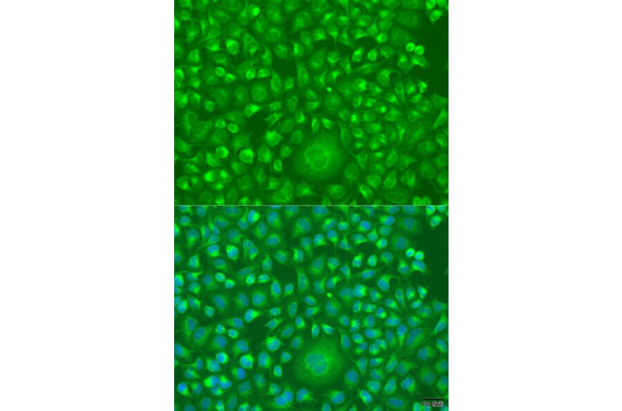 Immunofluorescence - Anti-IFNW1 Antibody (A15067) - Antibodies.com