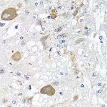 Immunohistochemistry of paraffin-embedded rat brain using Anti-IFNL3 Antibody (A12908) at dilution of 1:100 (40x lens).