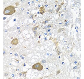 Immunohistochemistry - Anti-IL-28B Antibody (A92269) - Antibodies.com