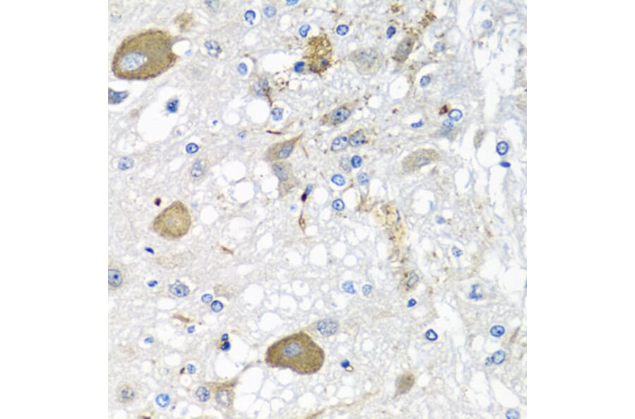 Immunohistochemistry - Anti-IL-28B Antibody (A92269) - Antibodies.com