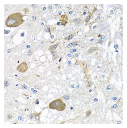 Immunohistochemistry - Anti-IL-28B Antibody (A92269) - Antibodies.com