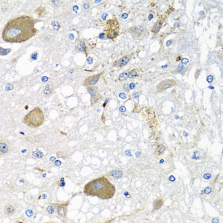 Immunohistochemistry - Anti-IL-28B Antibody (A92269) - Antibodies.com