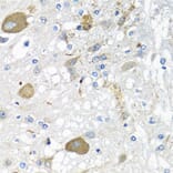 Immunohistochemistry - Anti-IL-28B Antibody (A92269) - Antibodies.com