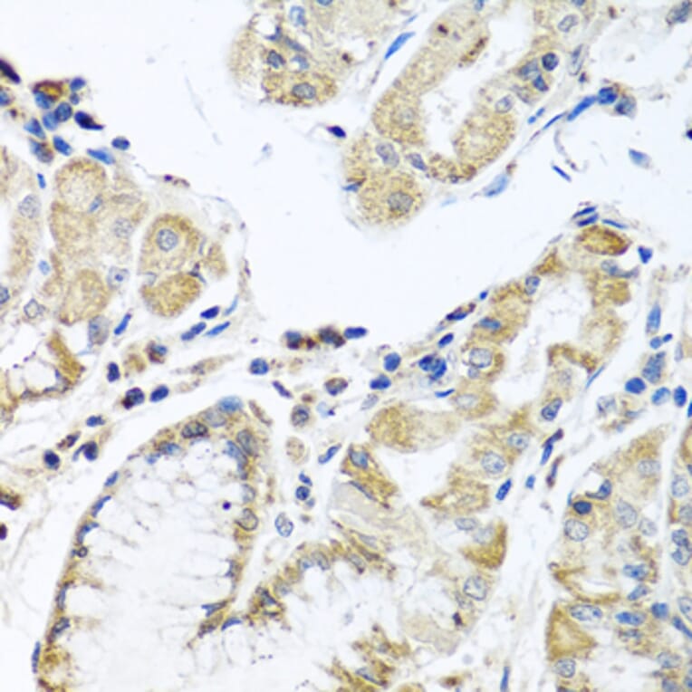 Immunohistochemistry - Anti-IL-28B Antibody (A92269) - Antibodies.com