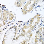 Immunohistochemistry - Anti-IL-28B Antibody (A92269) - Antibodies.com
