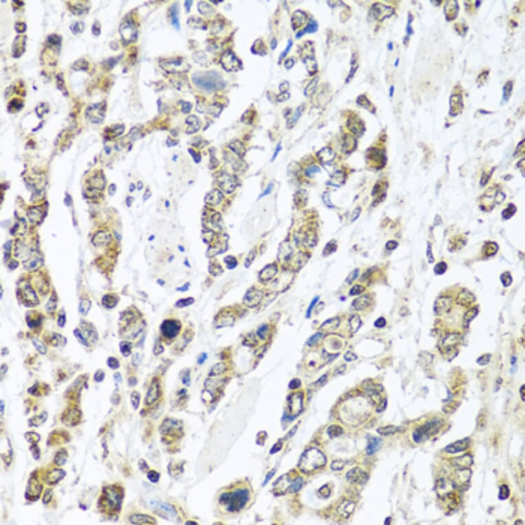 Immunohistochemistry - Anti-IL-28B Antibody (A92269) - Antibodies.com