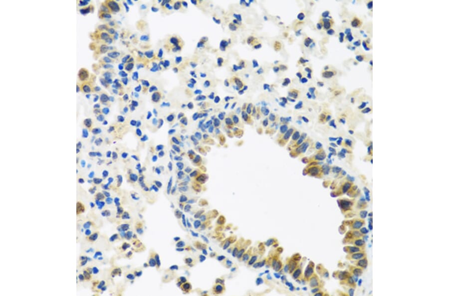 Immunohistochemistry - Anti-IL-28B Antibody (A92269) - Antibodies.com