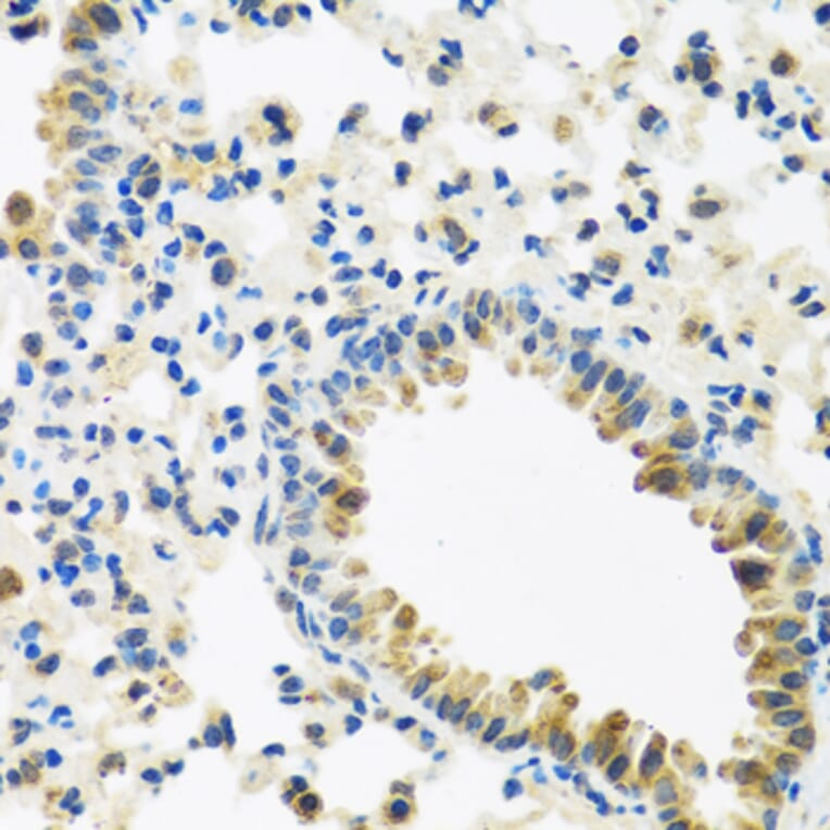 Immunohistochemistry - Anti-IL-28B Antibody (A92269) - Antibodies.com