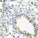 Immunohistochemistry - Anti-IL-28B Antibody (A92269) - Antibodies.com
