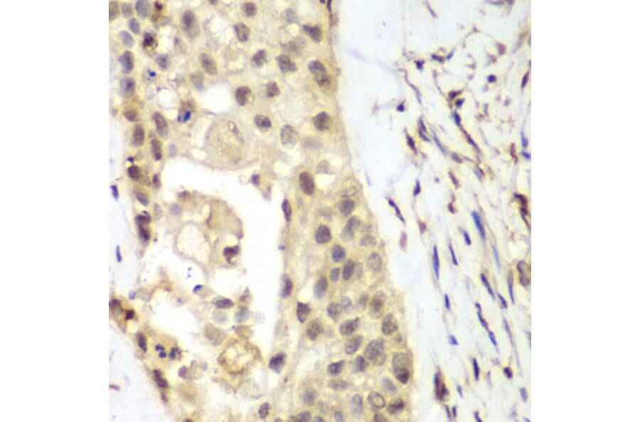 Immunohistochemistry - Anti-FGFR1 Antibody (A13493) - Antibodies.com
