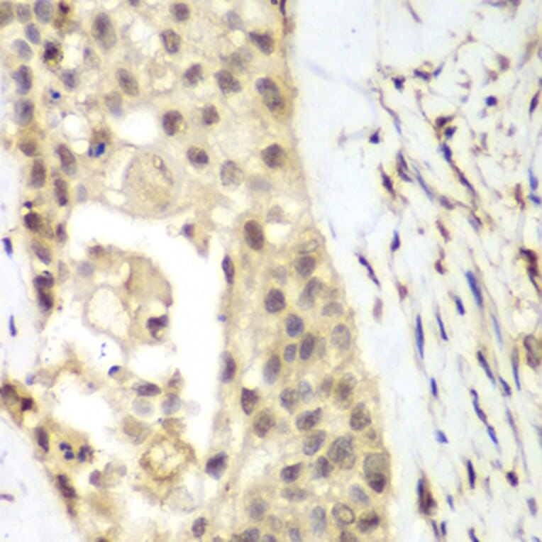 Immunohistochemistry - Anti-FGFR1 Antibody (A13493) - Antibodies.com