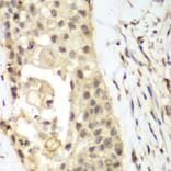 Immunohistochemistry - Anti-FGFR1 Antibody (A13493) - Antibodies.com