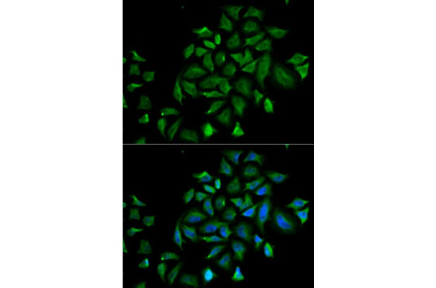 Immunofluorescence - Anti-FGFR1 Antibody (A13493) - Antibodies.com