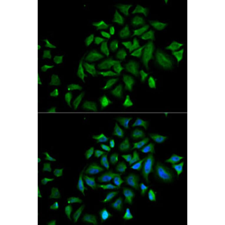 Immunofluorescence - Anti-FGFR1 Antibody (A13493) - Antibodies.com