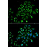 Immunofluorescence - Anti-FGFR1 Antibody (A13493) - Antibodies.com