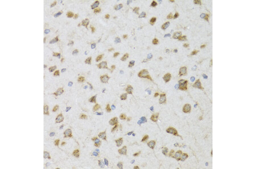 Immunohistochemistry - Anti-PI3 Antibody (A12482) - Antibodies.com