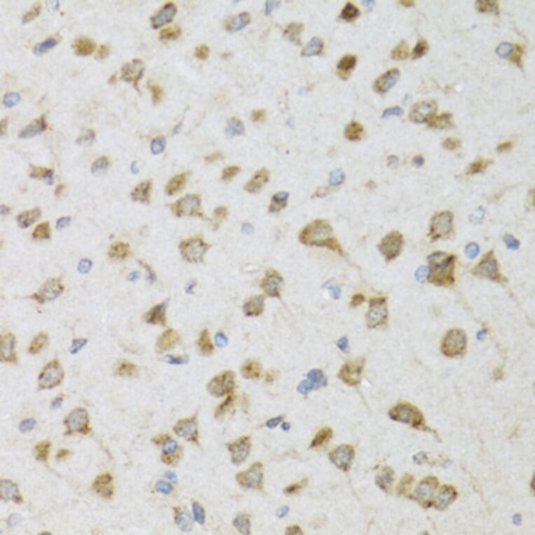 Immunohistochemistry - Anti-PI3 Antibody (A12482) - Antibodies.com