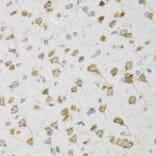 Immunohistochemistry - Anti-PI3 Antibody (A12482) - Antibodies.com
